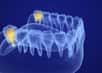 Notre crâne est plus aplati que celui des autres primates, les dents ont moins de place pour pousser. © Alexandr Mitiuc, Adobe Stock